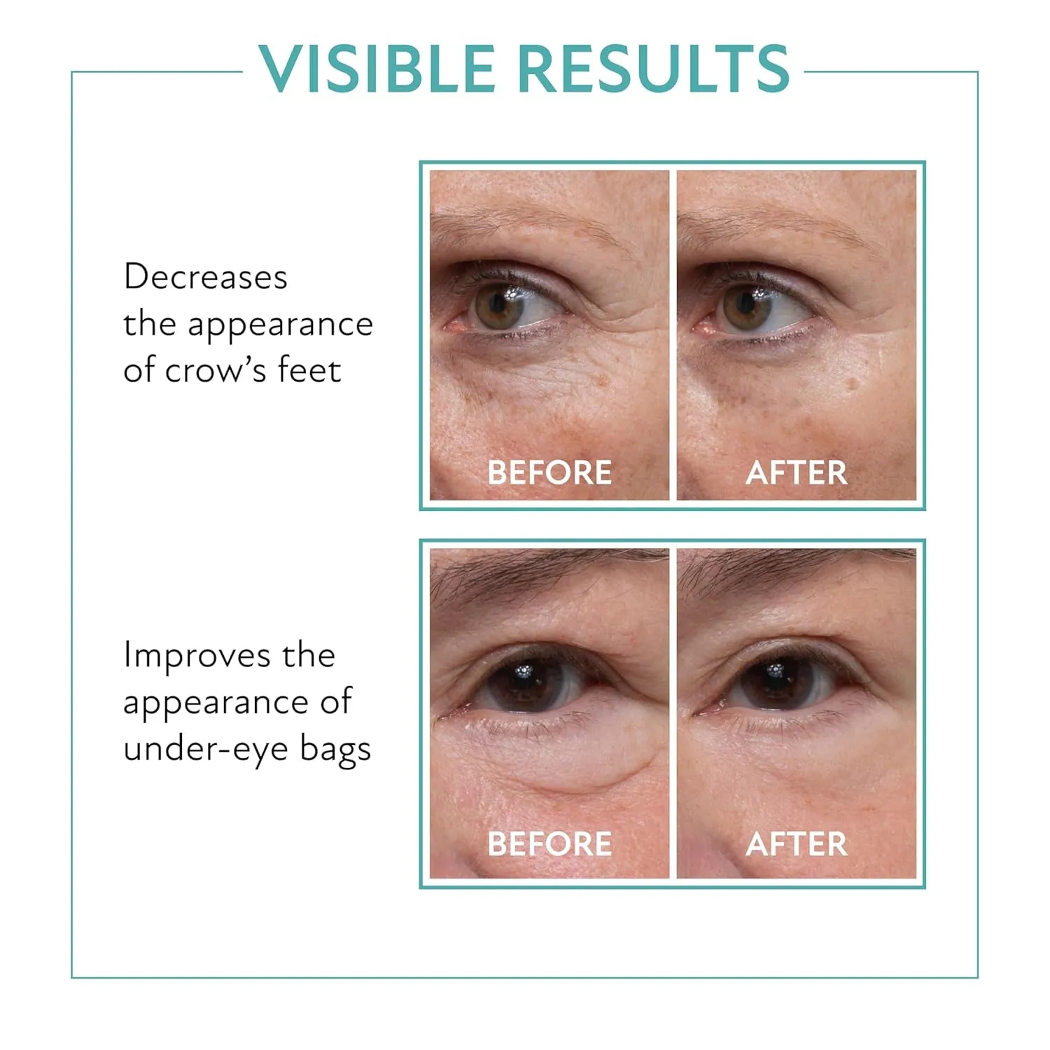 60 Second Eye Effects Tinted Firming Gel - Instant Tightening Serum, Under-Eye Cream for Puffiness and Bags - Light to Medium, 0.33 Fl Oz (10 Ml)