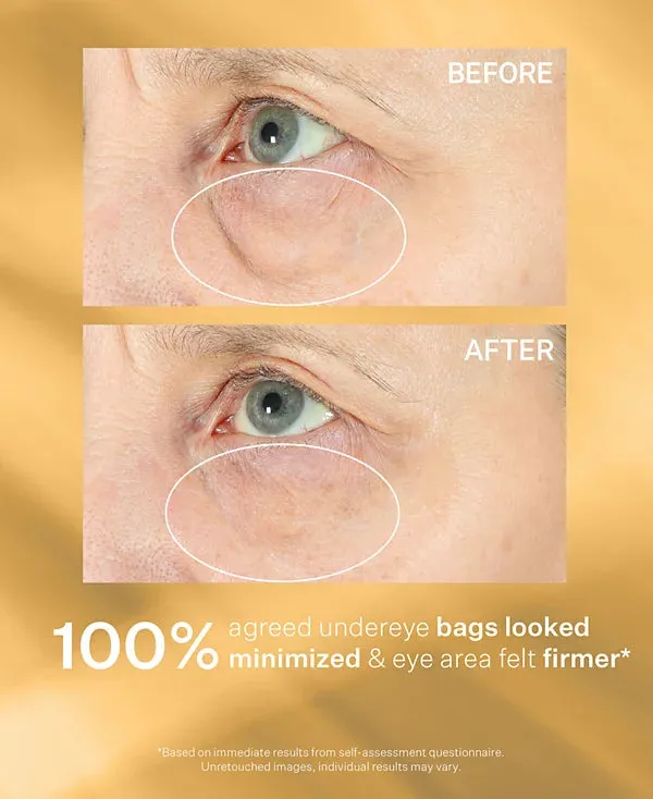 StriVectin Hyperlift Eye Instant Eye Fix 0.34 fl oz
